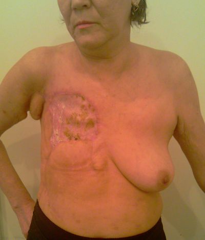 После лечения