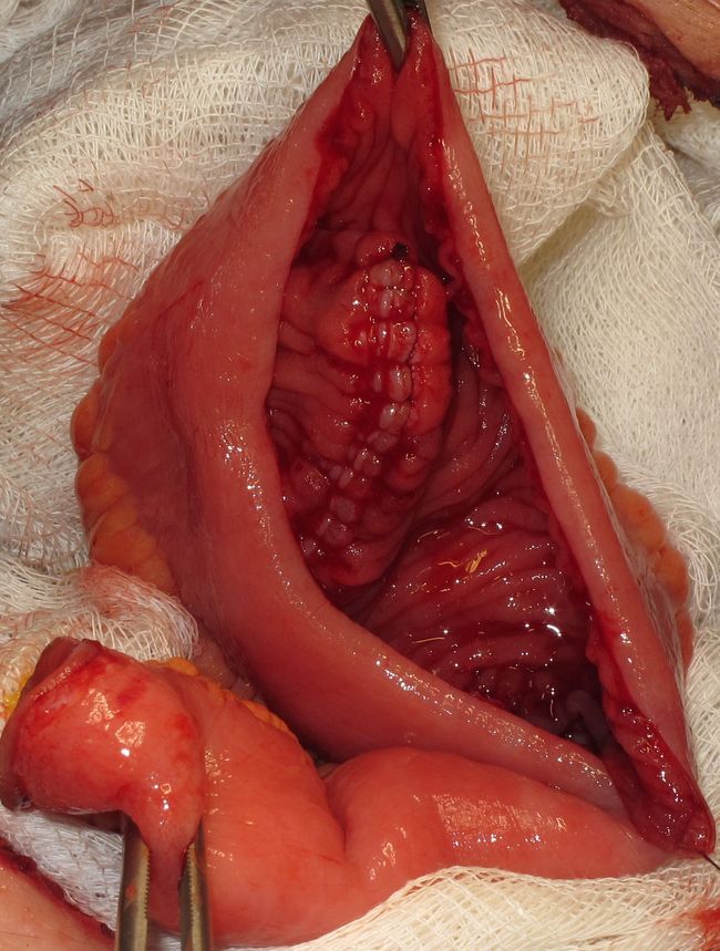 Формирование мочевого резервуара